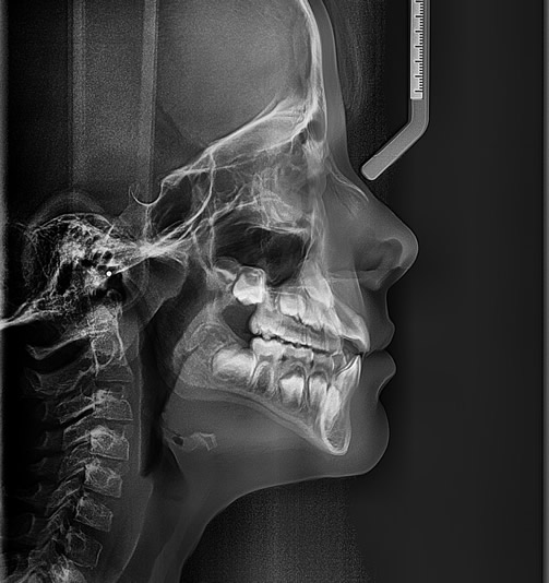 Telerradiografia