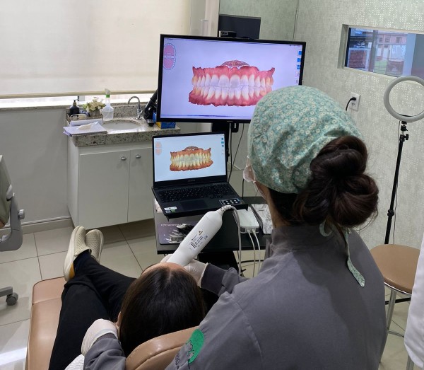 Escaneamento Intraoral